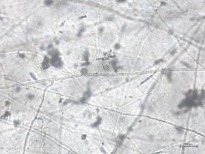 Globisporangium_irregulare_2