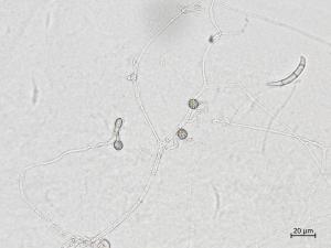 Neocosmospora_solani_4