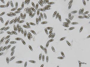 Neopestalotiopsis_sp_2