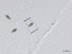 Neopestalotiopsis_sp_3