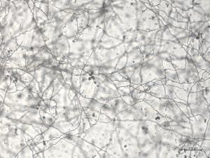 Phytophthora_cactorum_1