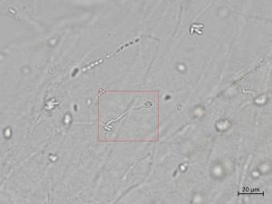 Plectosphaerella_cucumerina_5