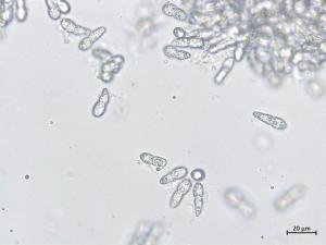 Diplocarpon coronariae