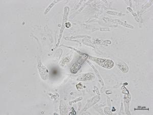 Chaetomium_sp_3