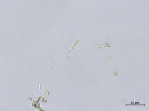 Colletotrichum_boninense_2