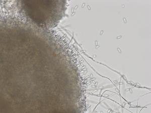 Colletotrichum_fioriniae_3