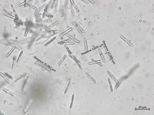 Coleophoma_empetri_3