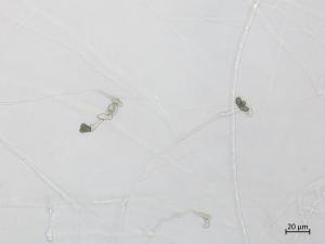 Colletotrichum_coccodes_15