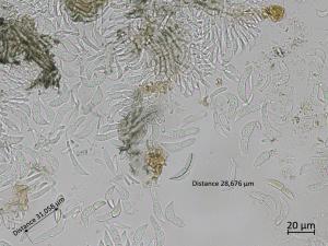 Diplocarpon_fragariae_7