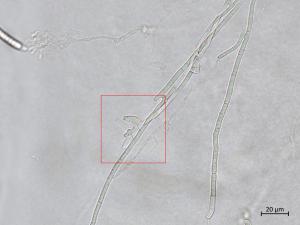 Fusarium_sambucinum_7