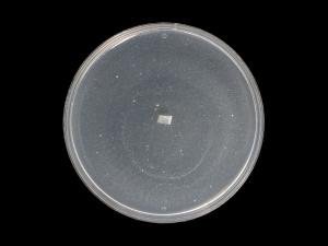 Globisporangium_irregulare_8