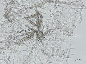 Helminthosporium_solani_8