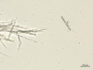 Phaeoacremonium_minimum_9