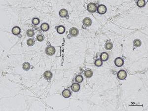 Phytophthora_erythroseptica_5