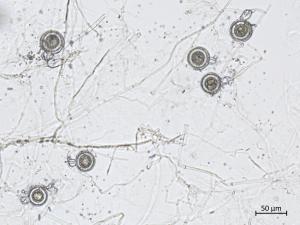 Phytophthora_erythroseptica_6