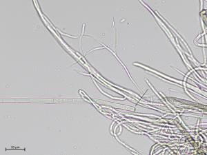 Cercospora_sp_2