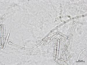 Calonectria_sp_2