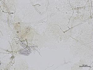 Calonectria_sp_3