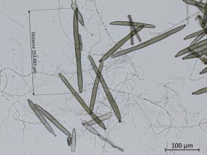 Corynespora_cassiicola_4