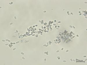 Diaporthe_sp_5