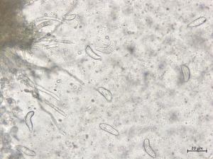 Drepanopeziza_ribis_2