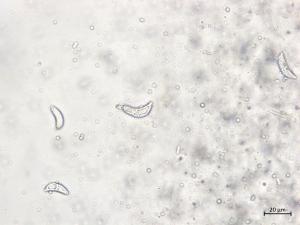 Drepanopeziza_ribis_3