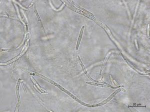 Fusarium_proliferatum_2