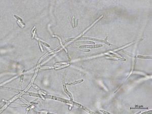 Fusarium_proliferatum_3