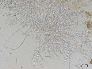 Fusarium_tricinctum_1