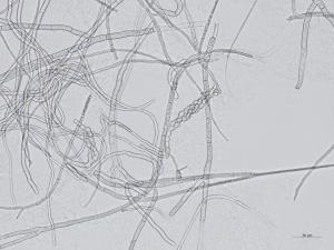 Monilinia_polystroma_2