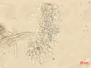 Neofusicoccum_parvum_6