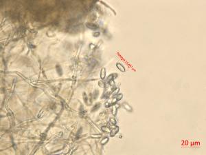 Neofusicoccum_parvum_7