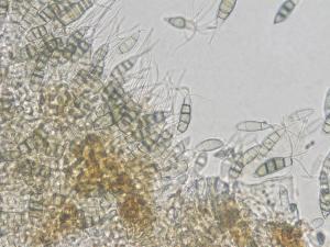 Neopestalotiopsis_clavispora_1