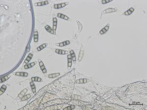 Neopestalotiopsis_clavispora_2