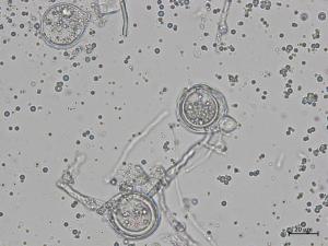 Phytophthora_cactorum_11