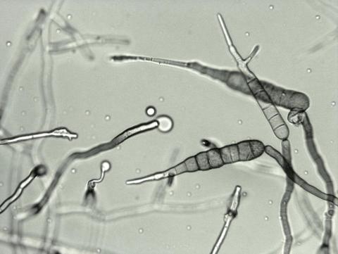 Alternaria_solani_10