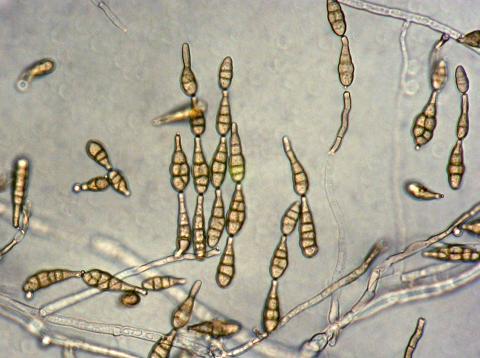 Alternaria_alternata_1