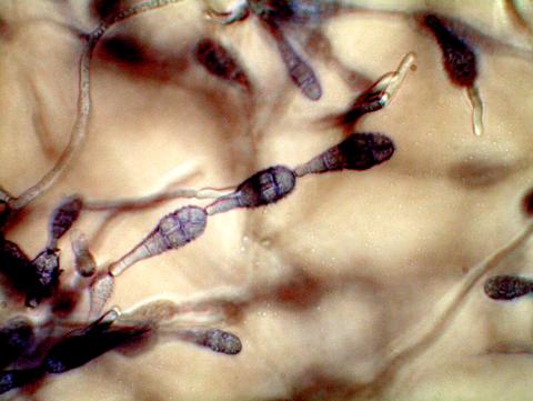 Alternaria_alternata_3