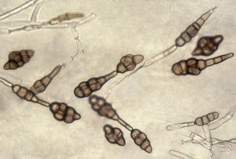 Alternaria_sp_3