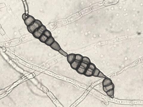 Alternaria_raphani_3