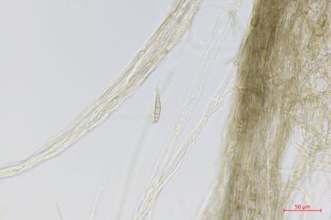 Alternaria_sp_2