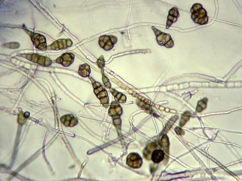 Alternaria_saponariae_1