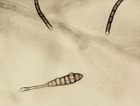 Alternaria_tagetica_3