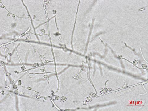 Colletotrichum_coccodes_D35079-1_LQ