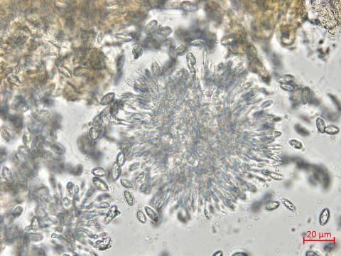 Coniella_diplodiella_1