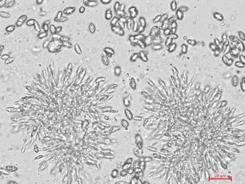 Coniella_diplodiella_3