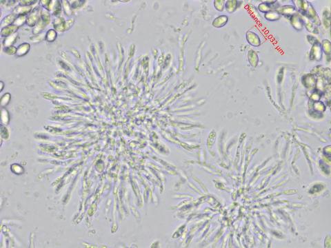 Coniella_diplodiella_4