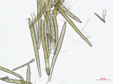 Corynespora_cassiicola_3