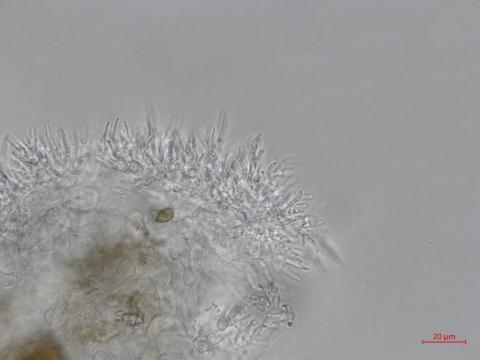 Cytospora_leucostoma_3