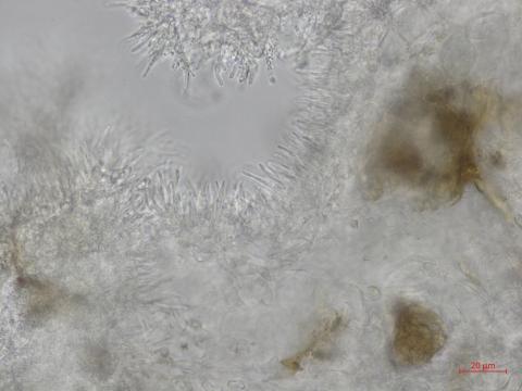 Cytospora_leucostoma_4